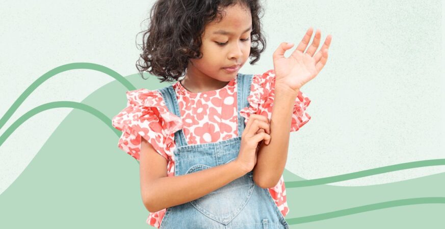 Atopic Dermatitis & ADHD-Like Symptoms in Kids: What to Know